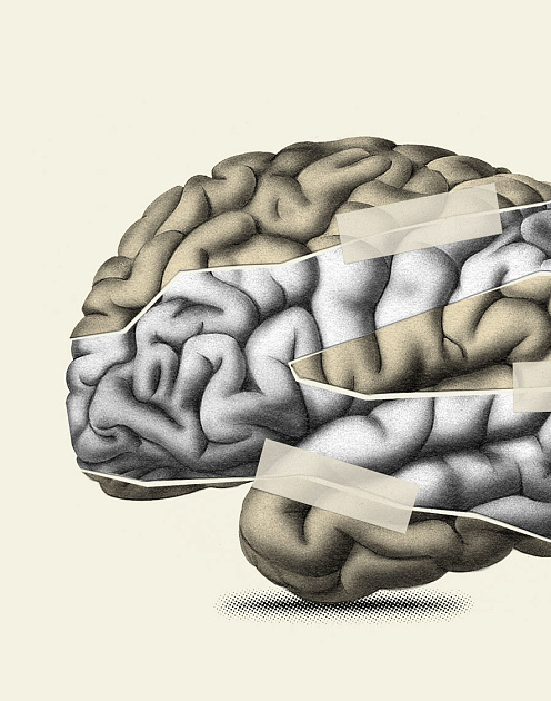 Мигрень — это серьезно. Чем может помочь работодатель?