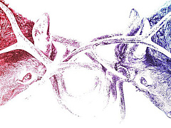 Борьба с диабетом в XXI веке