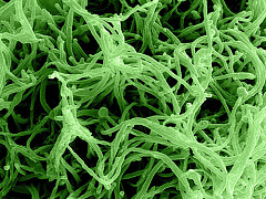 Что реально нужно сделать для борьбы с вирусом Эбола