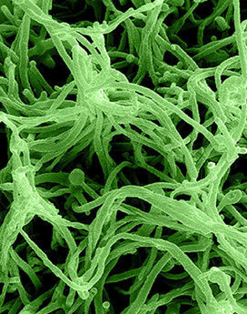 Что реально нужно сделать для борьбы с вирусом Эбола