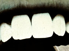 Как справиться с первопричиной стресса