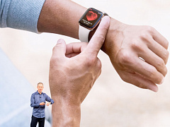 Почему врачам не стоит отказываться от Apple Watch