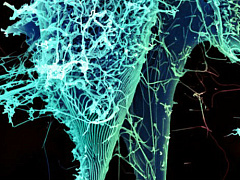 Борьба с Эболой как менеджмент страха