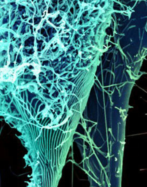 Борьба с Эболой как менеджмент страха