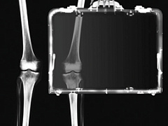 Врачи готовы, а пациенты?